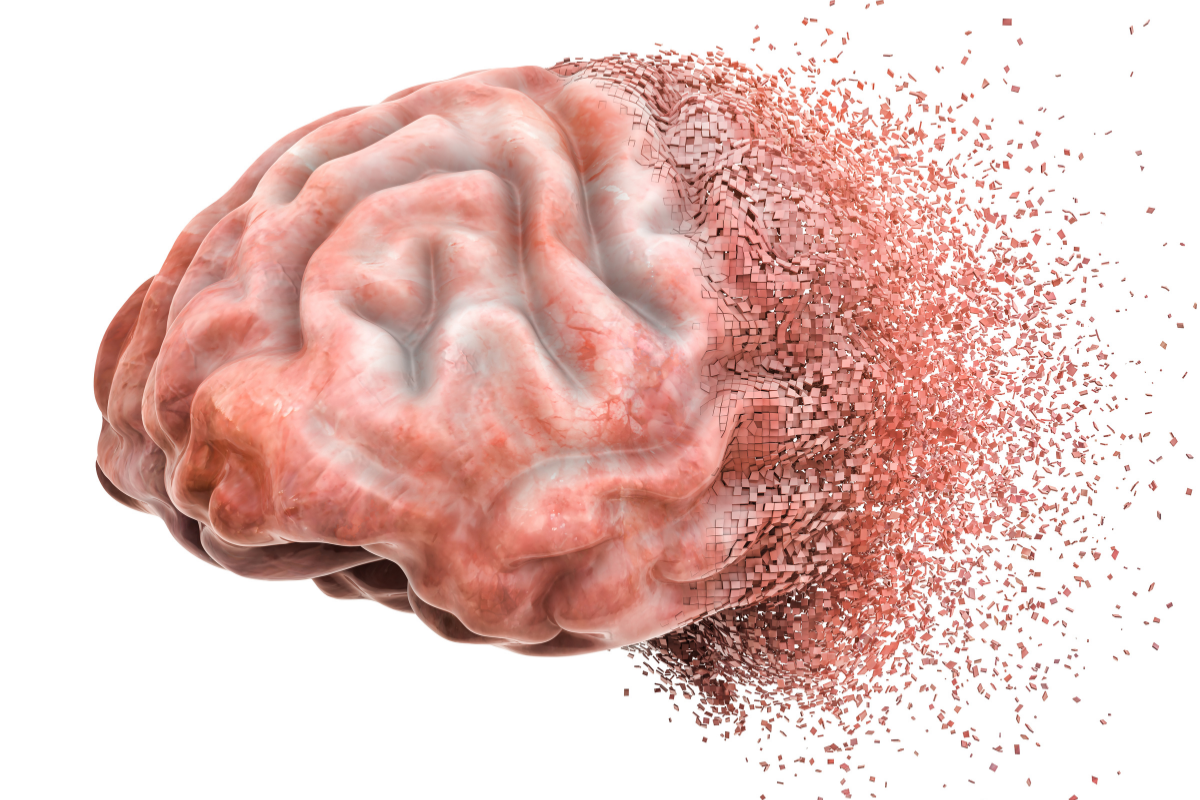 Medical tourism for neurology and stroke care article